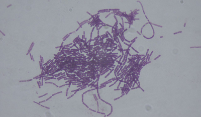 Bacillus thuringiensis - Foto: Wikimedia Commons