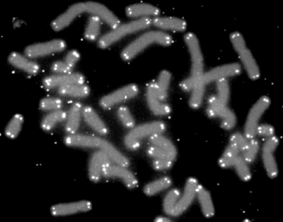 Cromossomos humanos (cinza) fechado por telômeros (branco)