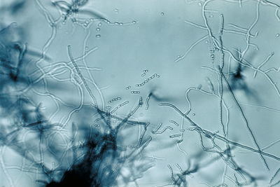 Cultura de bactérias Streptomyces - Foto: Wikimedia Commons