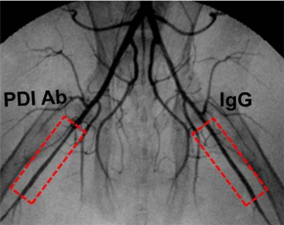 Angiografia representativa de artérias tratadas com PDI Ab (direita) e IgG – imunoglobina controle (esquerda). Caixas em vermelho demonstram regiões tratadas/analisadas