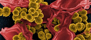 Superbactérias são um problema de saúde pública mundial, diz especialista