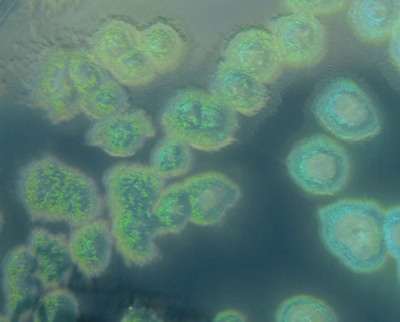 O processo, que faz com que as bactérias transitem da forma livre e nadante para a forma de biofilme bacteriano, foi descrito em nível molecular (Imagem: Pseudomonas aeruginosa em meio de cultura/Wikimedia Commons)