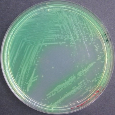 Bactéria Pseudomonas aeruginosa – Foto: Medicinal Plant Research Institute