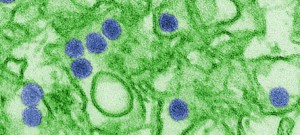 Para se proteger, vírus zika é capaz de modular inflamação no cérebro