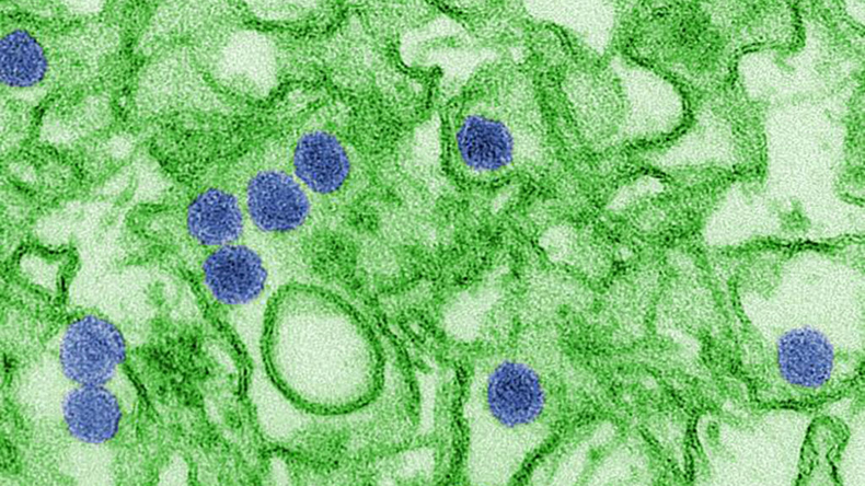Micrografia eletrônica do vírus Zika, em azul - Foto: Wikimedia Commons