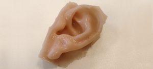 Técnica inovadora utiliza impressão 3D para produzir próteses auriculares