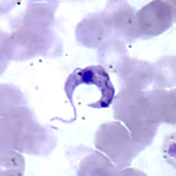 Enzima estudada também é essencial para a sobrevivência do Trypanosoma cruzi, parasita causador da doença de Chagas - Foto: Wikimedia Commons