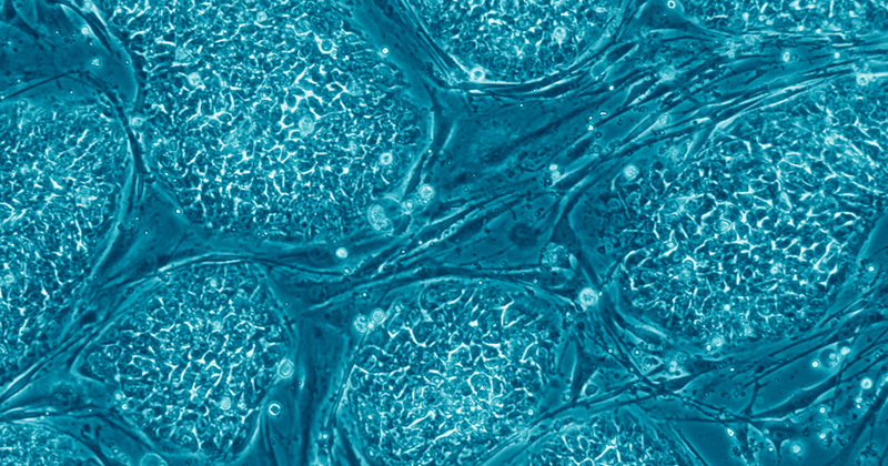 Células estaminais embrionárias humanas - Imagem: Nissim Benvenisty via Wikimedia Commons