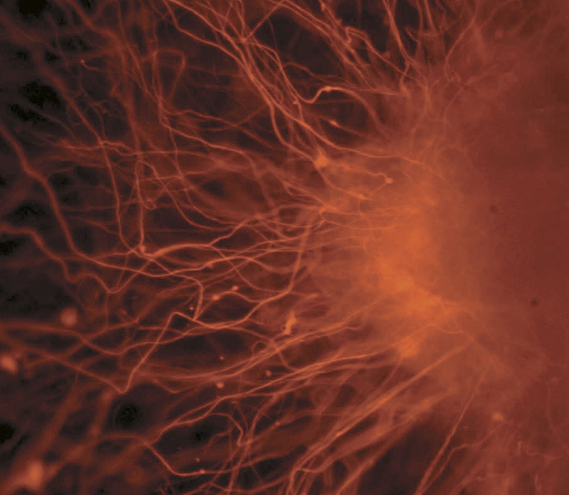 As células nervosas, um exemplo de um tipo de célula após a diferenciação Imagem: Nissim Benvenisty via Wikimedia Commons
