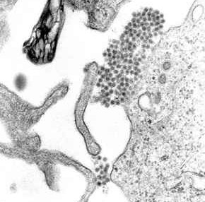 Uma microfotografia MET mostrando vírions do vírus da dengue (aglomerado de pontos escuros próximo ao centro) - Imagem: CDC via Wikimedia Commons