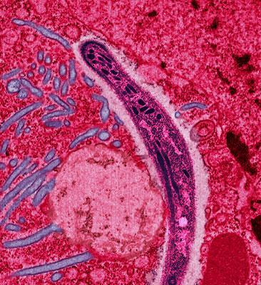 O parasita Plasmodium ao atravessar o citoplasma de uma célula epitelial da fêmea do mosquito, na forma com que penetra no corpo do ser humano e de outros vertebrados - Foto: Ute Frevert via Wikimedia Commons