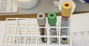 Jejum para exames de sangue não é mais consenso na classe médica