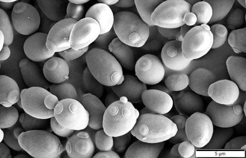 Saccharomyces cerevisiae, electron micrograph - Foto: Mogana Das Murtey e Patchamuthu Ramasamy via Wikimedia Commons