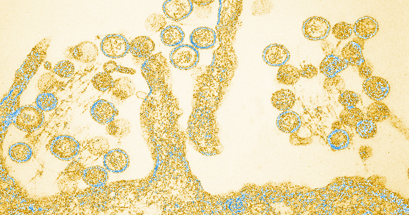 Micrografia eletrônica de transmissão do hantavirus - CDC/Cynthia Goldsmith via Wikimedia Commons
