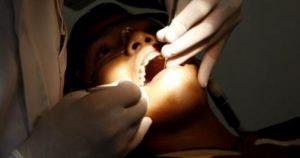 Fita anestésica criada na USP é aliada contra o medo de dentista
