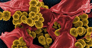 Identificado mecanismo que reduz imunidade após infecção generalizada