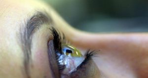 Glaucoma ainda é motivo de dúvidas na população