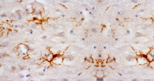 Células de apoio do sistema nervoso ajudam a entender o Alzheimer
