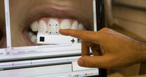 Mau hálito, dentes sensíveis e materiais odontológicos são temas de publicação