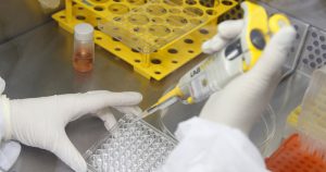 Células modificadas podem beneficiar pacientes do SUS com leucemia