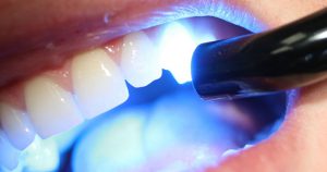 Em tempos de pandemia, teleodontologia pode avaliar necessidade de ida ao dentista