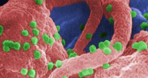 Vírus HIV prejudica tratamento de doenças no organismo humano