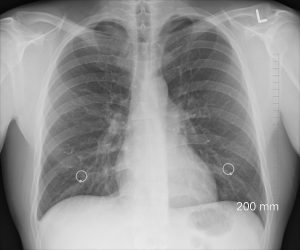 Boletim explica o funcionamento dos pulmões