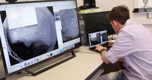 Inteligência computacional poderá facilitar exames de endoscopia