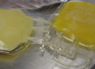 Duas bolsas de plasma fresco congelado. A bolsa à esquerda foi obtida de um paciente com hipercolesterolemia - Foto: DiverDave via Wimedia Commons / CC BY-SA 3.0