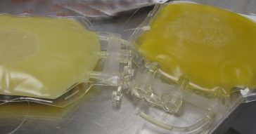 Duas bolsas de plasma fresco congelado. A bolsa à esquerda foi obtida de um paciente com hipercolesterolemia - Foto: DiverDave via Wimedia Commons / CC BY-SA 3.0