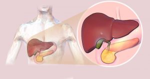 Cirrose alcoólica e hepatites são as doenças que mais levam ao transplante de fígado