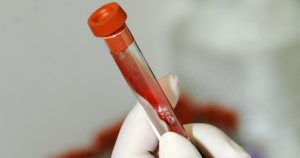 Novo medicamento para hemofilia requer menos aplicações
