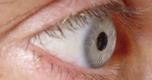 Detectada no olho humano alteração em proteínas que pode estar ligada a catarata