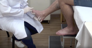 Vídeo traz orientações para controle de lesões da hanseníase