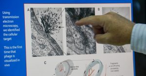 Vírus dedo-duro aponta células que blindam vasos sanguíneos do cérebro