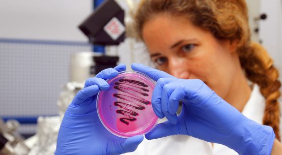 A imagem mostra uma mulher de jaleco branco, cabelos castanhos ondulados e presos, usando luvas azuis. Ela está em um ambiente de laboratório e segura uma placa transparente rosa com estrias escuras feitas provavelmente por uma técnica de microbiologia. Ao fundo, é possível observar equipamentos científicos desfocados. A expressão da mulher analisa o conteúdo da placa.