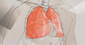 Ultrassonografia pulmonar: ferramenta de prognóstico essencial na luta contra a pandemia