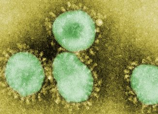 Os coronavírus são um grupo de vírus com aparência de auréola ou coroa (coroa) quando vistos ao microscópio eletrônico. O coronavírus agora é reconhecido como o agente etiológico do surto de SARS - Foto: CDC / Dr. Fred Murphy / Phil via Wikimedia Commons / Domínio público