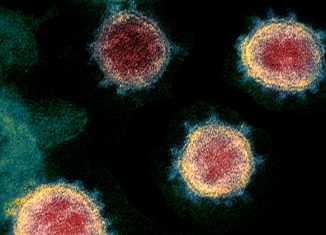 Imagem do microscópio eletrônico de transmissão mostra o SARS-CoV-2, o vírus que causa o COVID-19 - Foto: NIAID / NIH via Wikimedia Commons / Domínio público