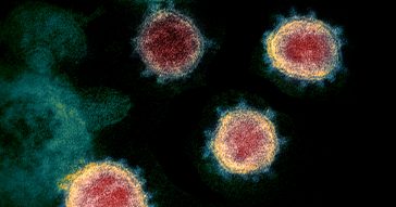 Imagem do microscópio eletrônico de transmissão mostra o SARS-CoV-2, o vírus que causa o COVID-19 - Foto: NIAID / NIH via Wikimedia Commons / Domínio público