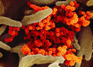 Imagem do microscópio eletrônico de transmissão mostra o SARS-CoV-2 (laranja), o vírus que causa o COVID-19 - Foto: NIAID / NIH via Wikimedia Commons / Domínio público