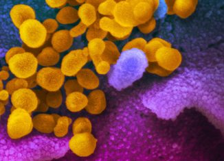 Imagem do microscópio eletrônico de transmissão mostra o SARS-CoV-2 (amarelo), o vírus que causa o COVID-19 - Foto: NIAID / NIH via Wikimedia Commons / Domínio público