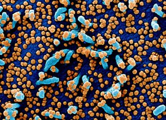 Micrografia eletrônica de varredura colorida de uma célula VERO E6 (azul) fortemente infectada com partículas do vírus SARS-CoV-2 (laranja)  - Foto: NIAID