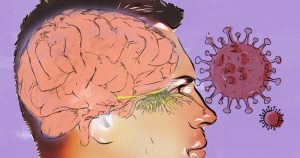 De falta de olfato a AVC e crise epiléptica: crescem sintomas neurológicos associados à covid-19