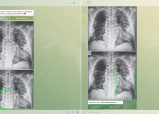 Com a Marie os agrupamentos das imagens já conseguiram detectar as diferenças entre as imagens de pulmões afetados pela covid-19 e as imagens daqueles afetados pela tuberculose