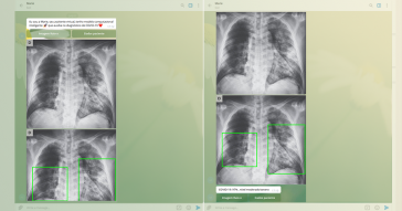 Com a Marie os agrupamentos das imagens já conseguiram detectar as diferenças entre as imagens de pulmões afetados pela covid-19 e as imagens daqueles afetados pela tuberculose