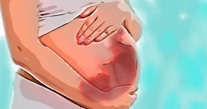 Placenta de bebê com microcefalia é menos resistente ao zika vírus
