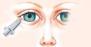 Cientistas apontam procedimento anestésico que causa menos dor em cirurgias do olho
