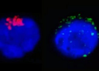 Na imagem da esquerda é possível observar a enzima RdRp do SARS-CoV-2 (em vermelho), que regula a replicação viral, no interior do linfócito T CD4.Na imagem da direita, as manchas verdes representam as proteínas de espícula do SARS-CoV-2 (spike proteins) próximas à membrana da célula de defesa humana  - Foto:: imagem: Henrique Marques-Souza/Unicamp)