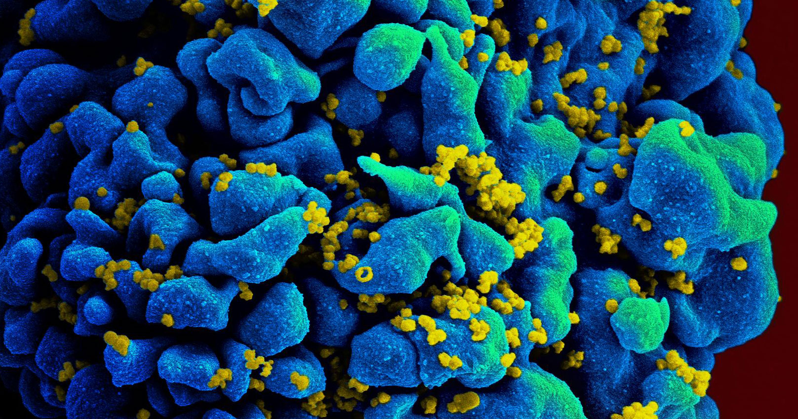 Cópias do vírus HIV (em amarelo) infectam uma célula T humana (em azul) - Foto: NIAID